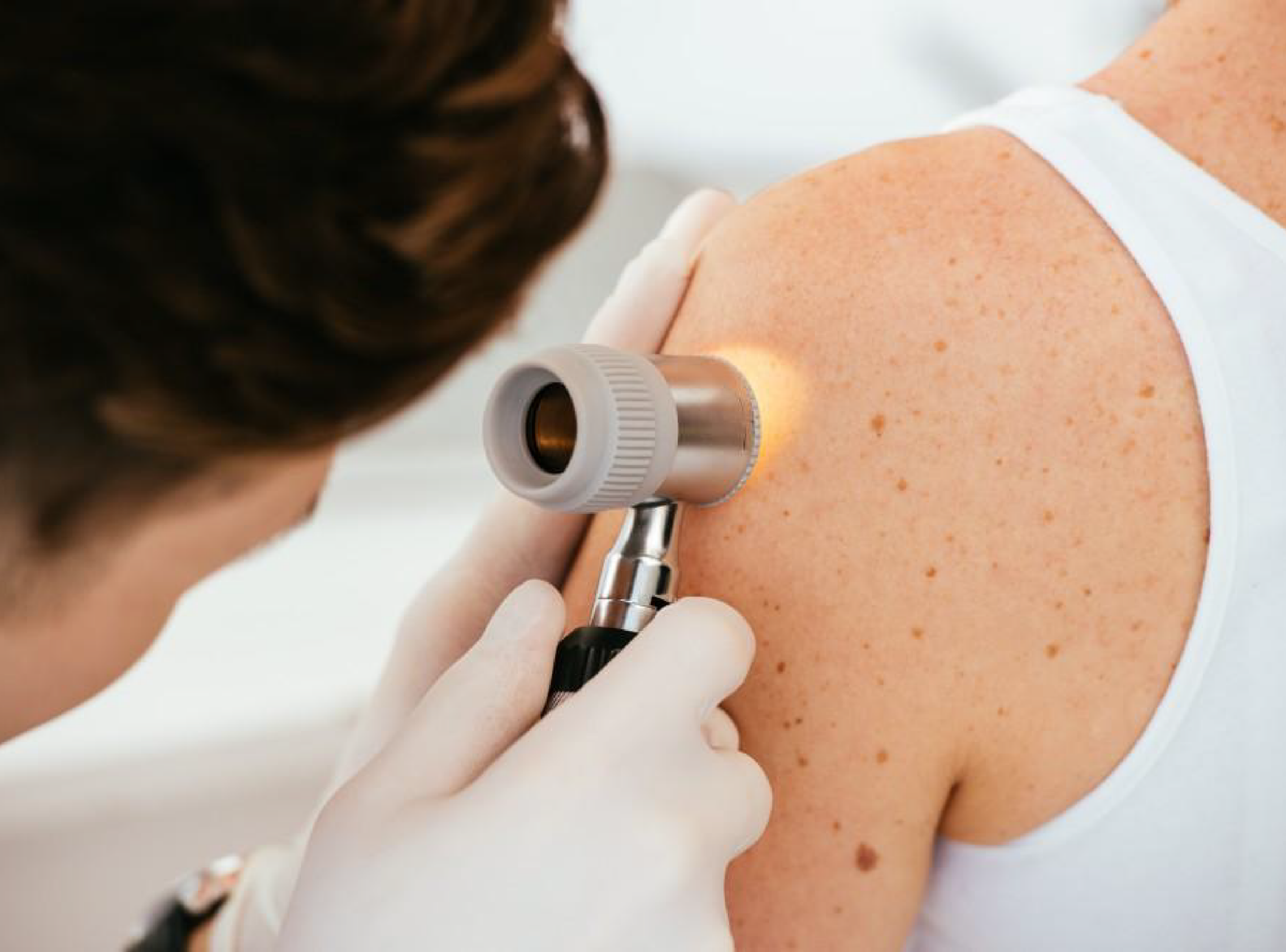 Skin Checks Outer Banks Dermatology
